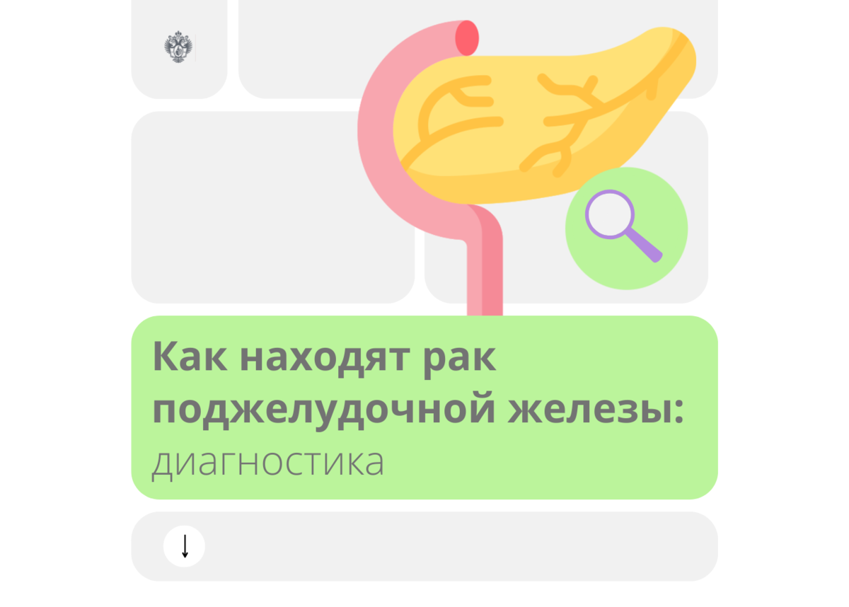 Как находят рак поджелудочной железы: диагностика