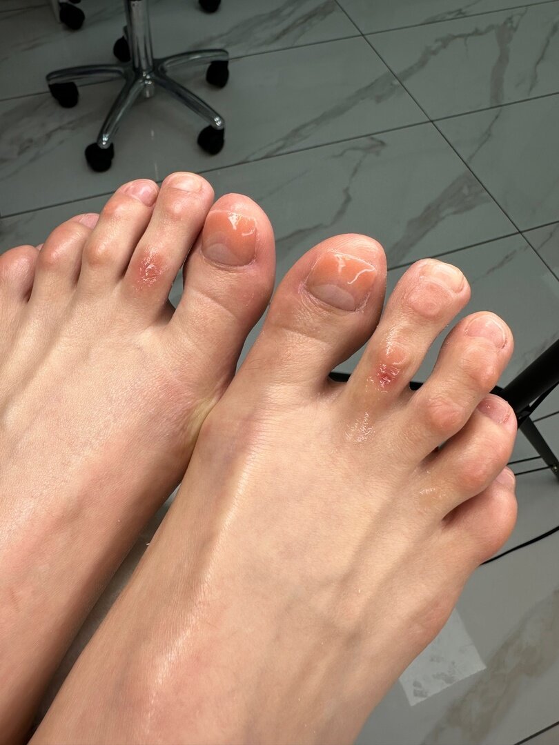 -2