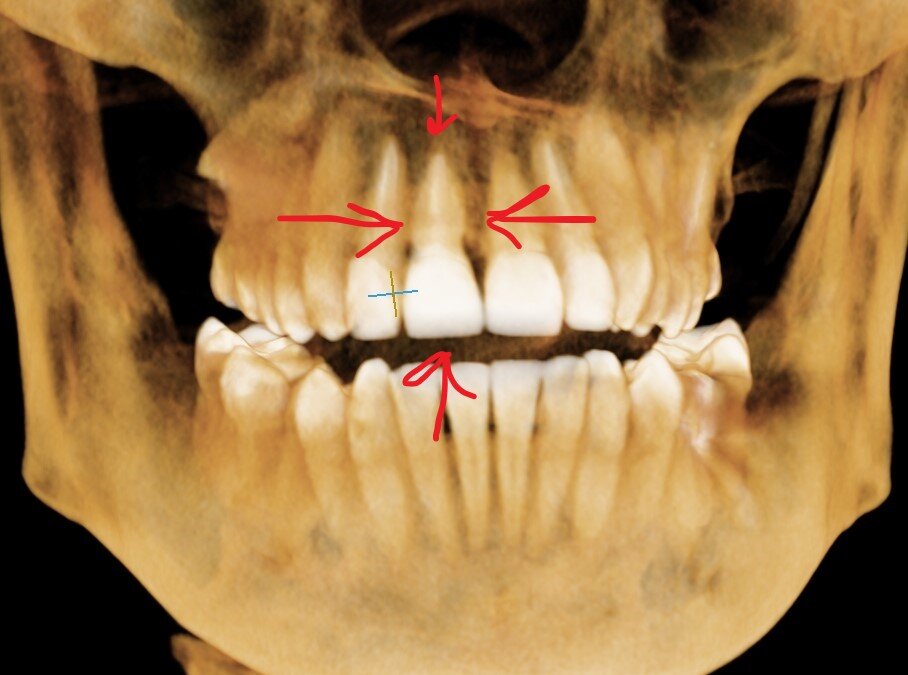 3Д визуализация костных структур и зубов.