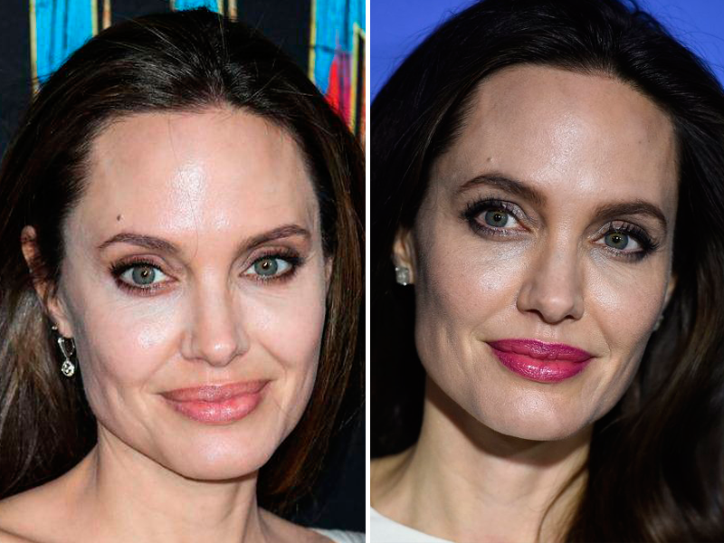Старение усталое лицо. Мелкоморщинистый морфотип старения. Анджелина Джоли усталый Тип старения. Деформационный морфотип старения.
