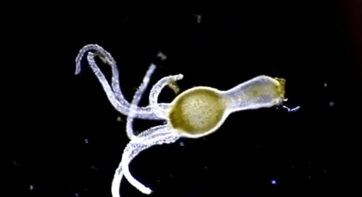 Гидра, фото сделано электронным микроскопом.