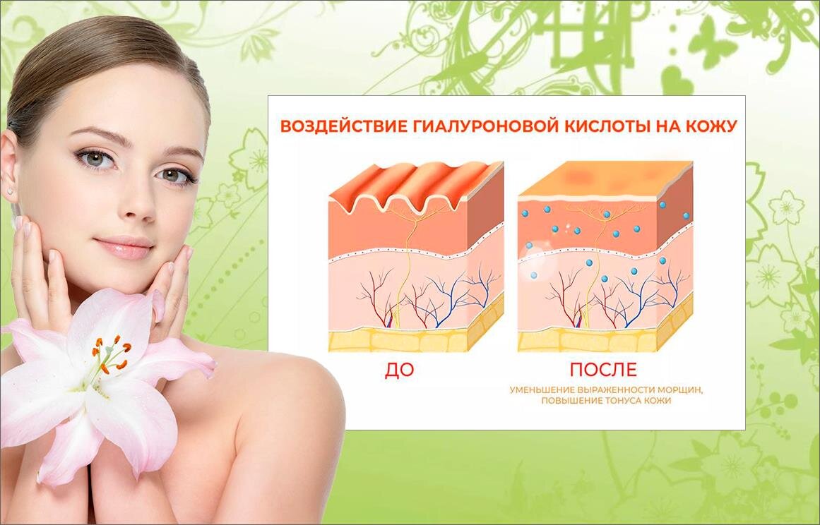 Коллаж автора