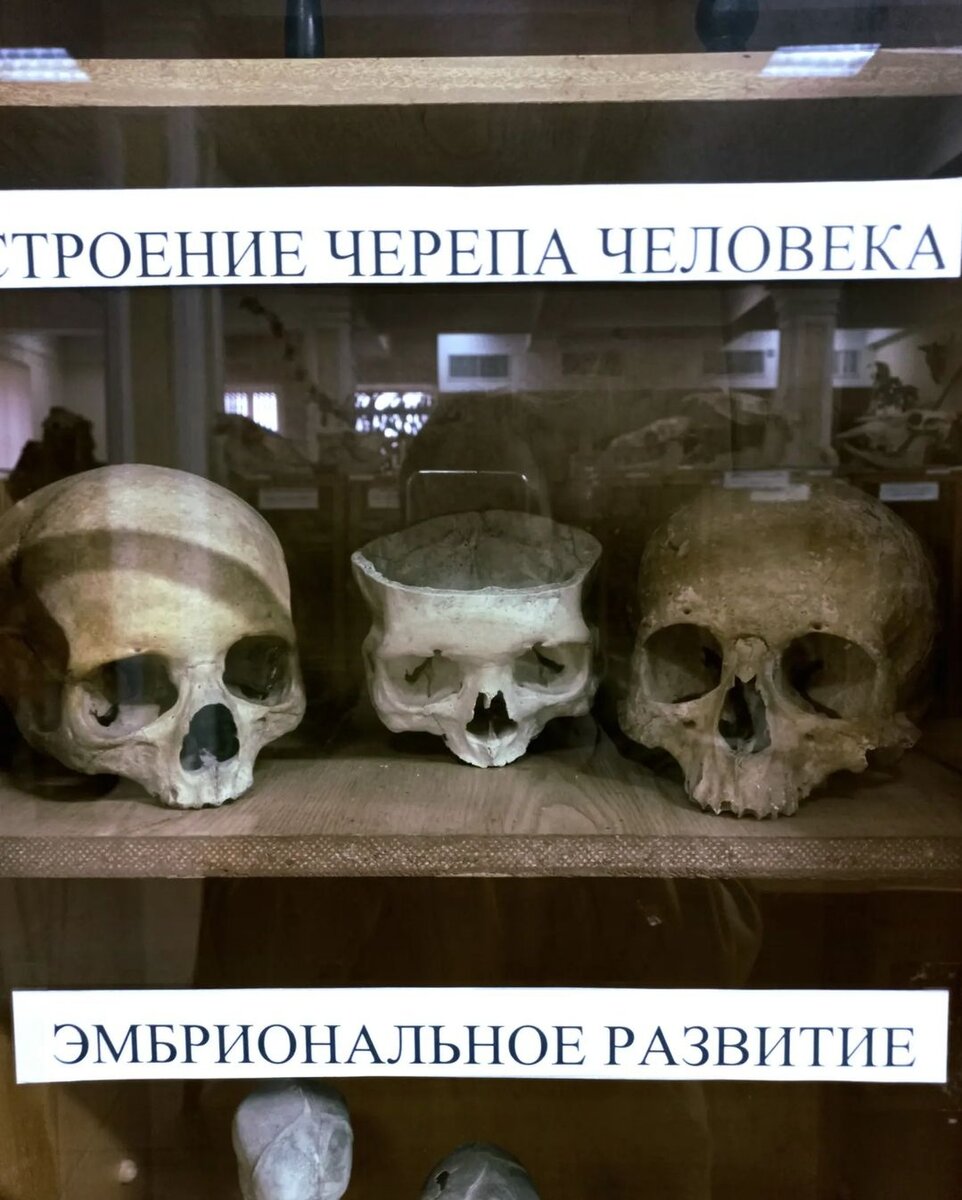 Музей анатомия Москва Гиндце. Анатомический музей РУДН. Экспонаты анатомического музея. Анатомический музей Москва.