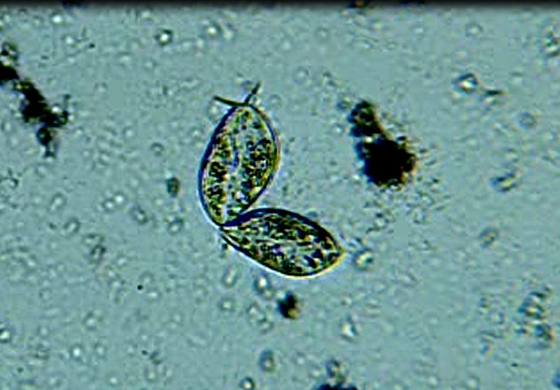 https://commons.wikimedia.org/wiki/File:Love,_Paramecium_Aurelia.jpg