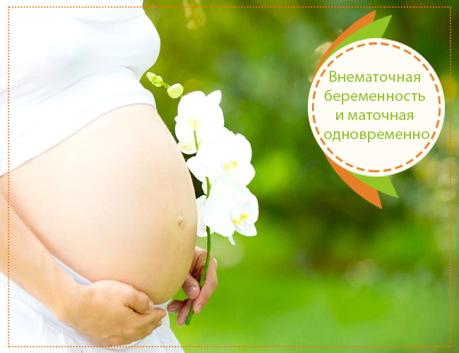 Из Яндекс картинок