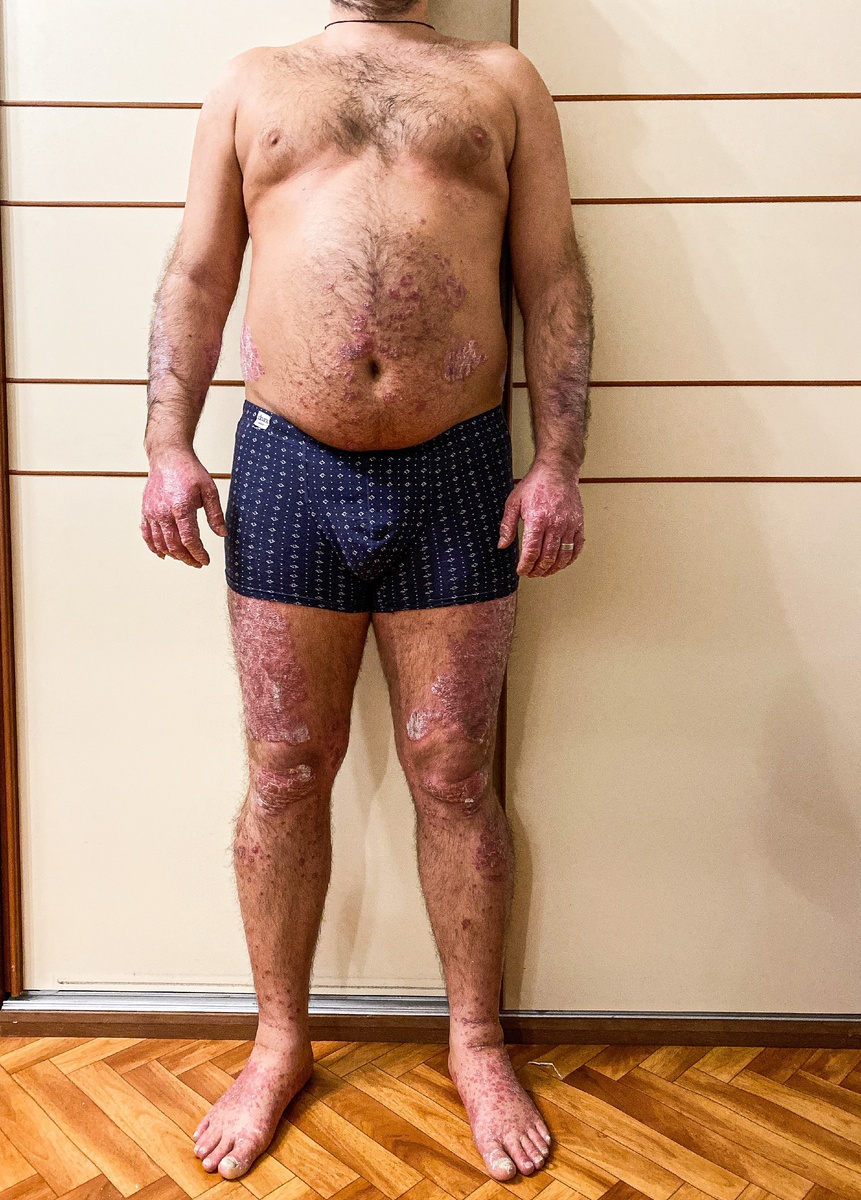 Листабельно, сохраним как До....