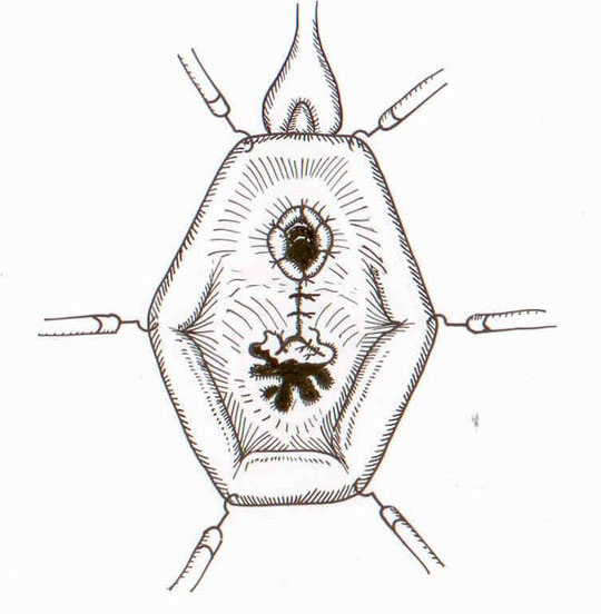 Транспозиция уретры.
