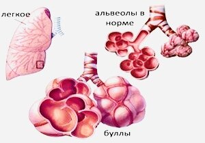 Никаких надуваний шариков и пускания  бульбашек в воду! Что такое буллы