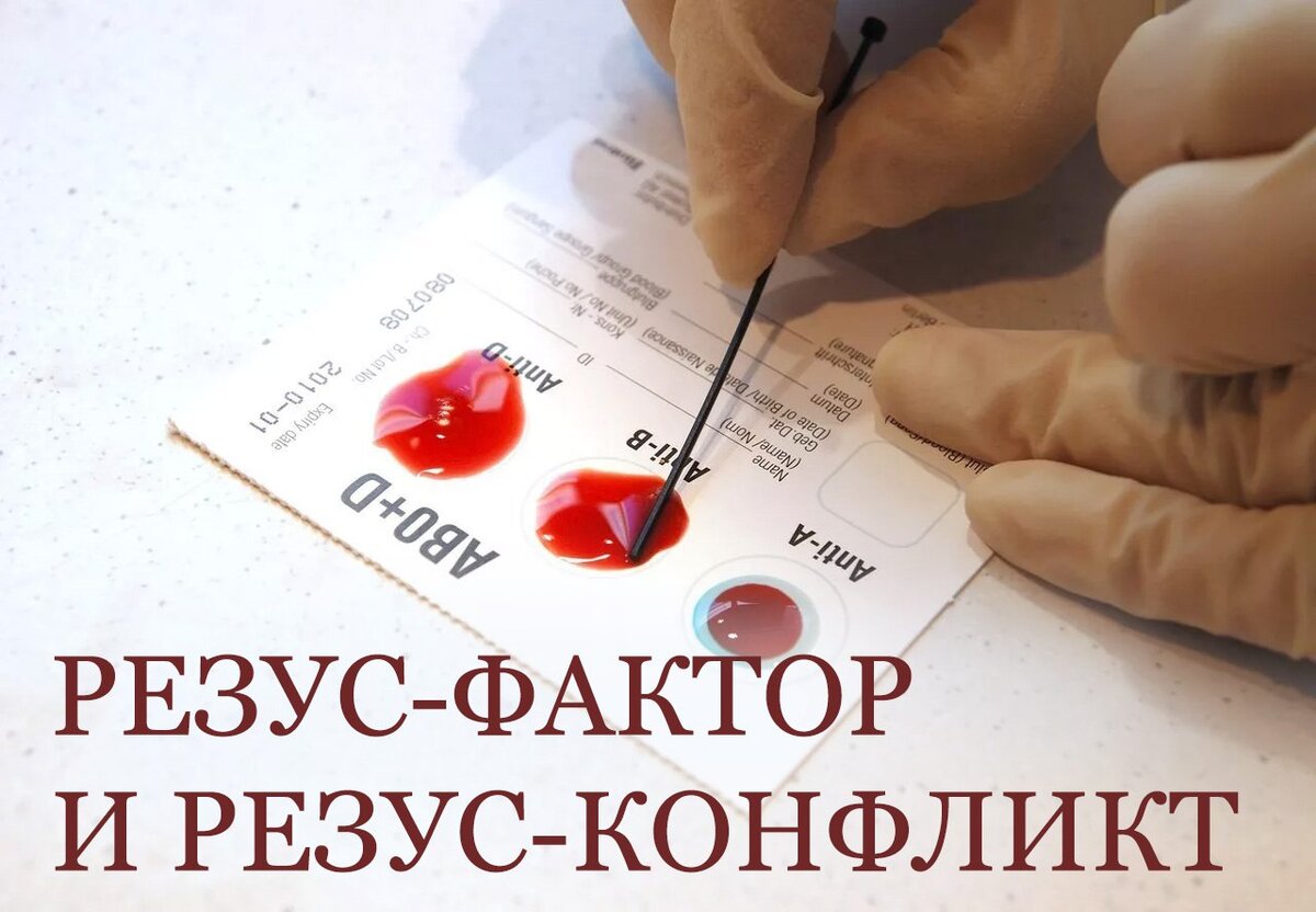 Резус-фактор и резус-конфликт