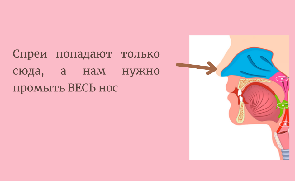 Постназальный затек картинки. Заразен ли постназальный затек.