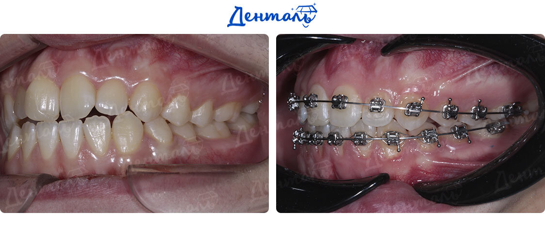 Примеры лечения