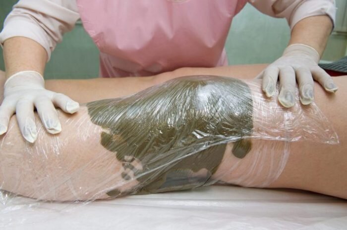 Листья лопуха используют для компрессов при болях в суставах