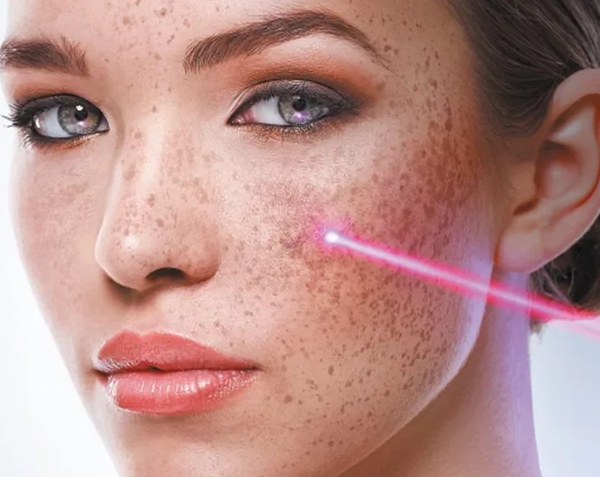 Фотография взята из источника pilingskin.ru