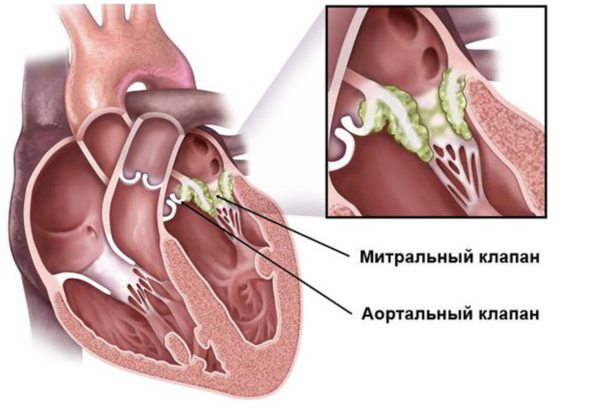 Интересует ли зрелых женщин секс с молодым парнем?