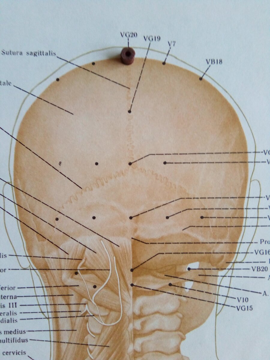 Листайте галерею.