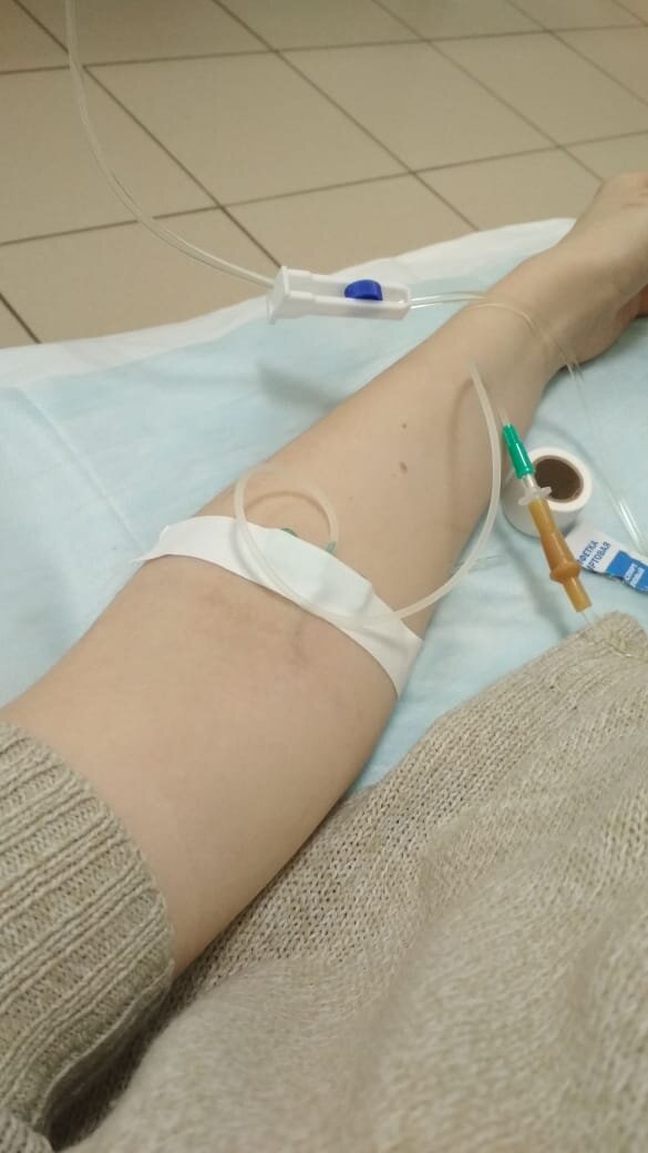 Процедура постановки капельницы.