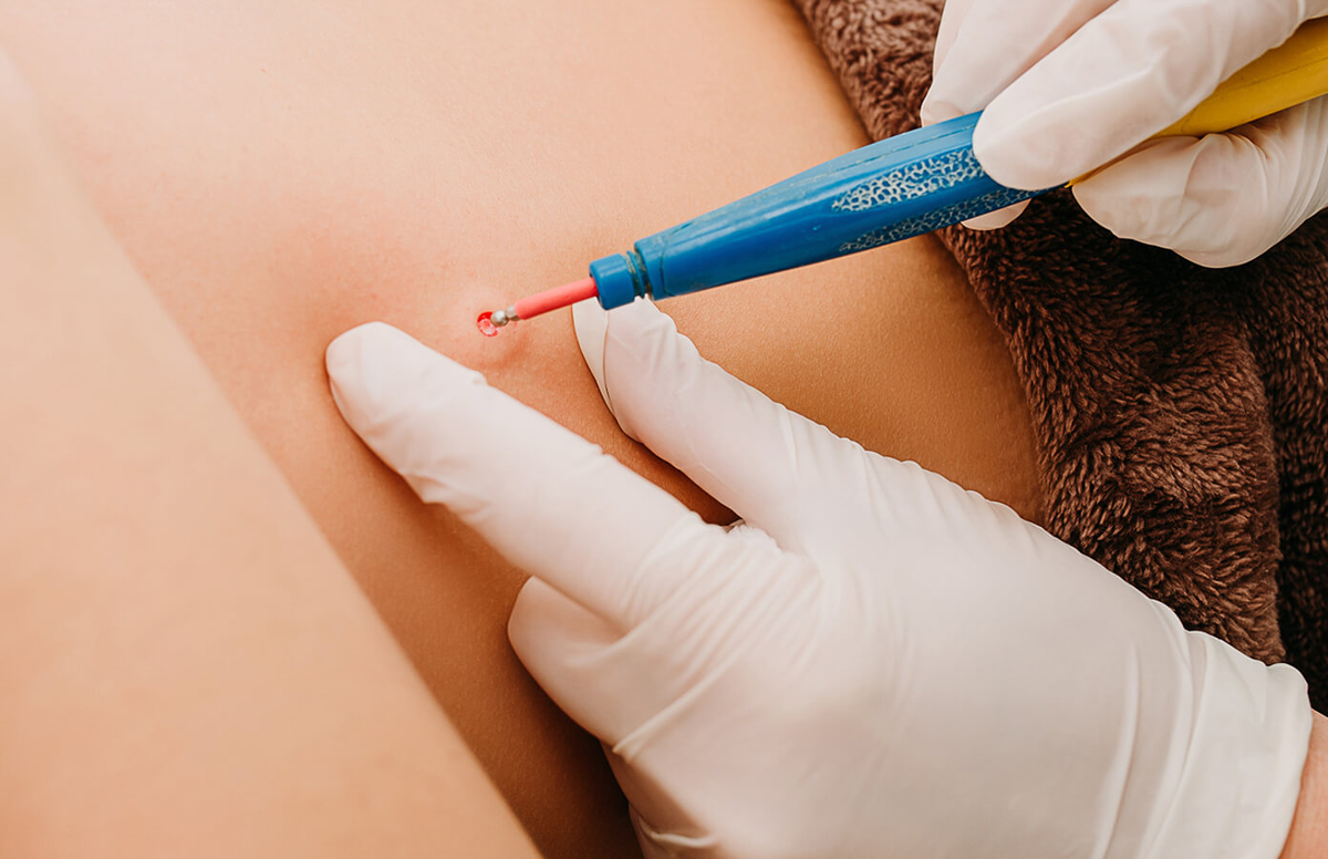 Источник: Яндекс-картинки