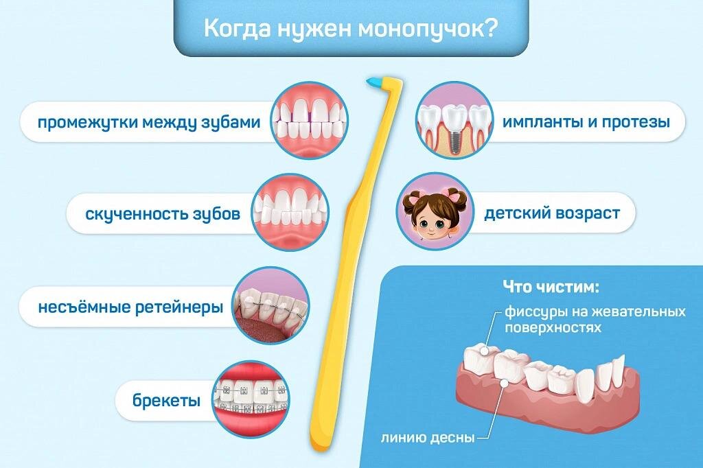 Ситуации, в которых нужен монопучок