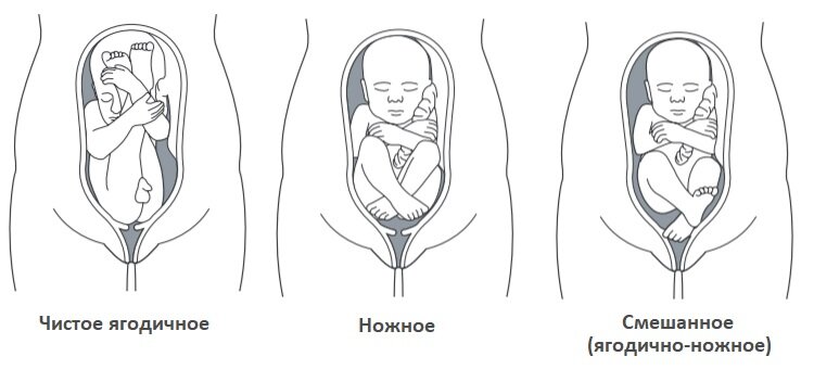 Позиция вид предлежание