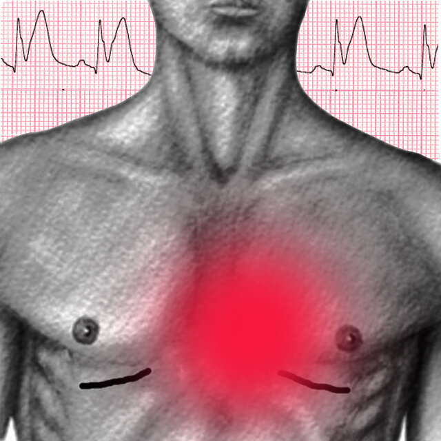 Боль за грудиной это где в картинках