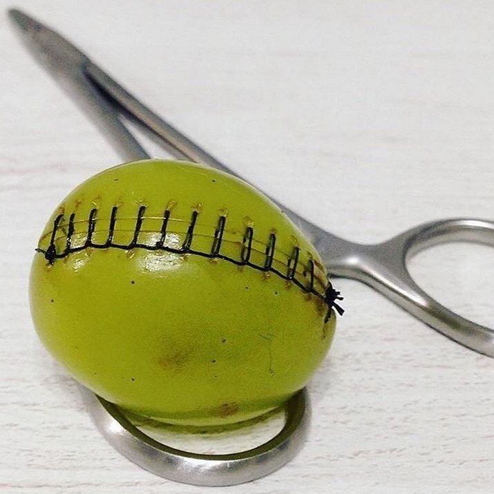 "Операция" на ягоде винограда. Фото с Yandex.ru