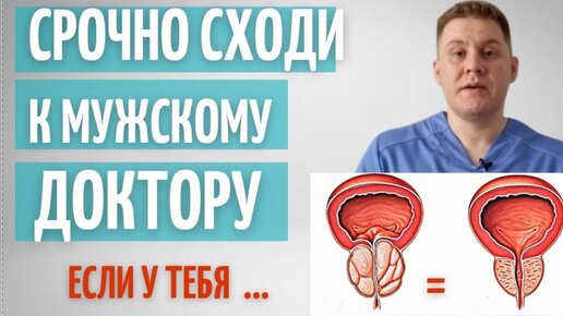 Срочно сходи к мужскому доктору если у тебя.. Каримов Расим Ринатович Врач уролог-андролог с более чем 5-летним стажем.