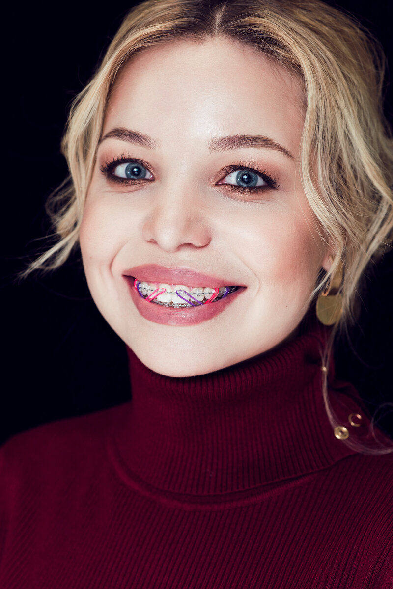 Кстати, многие пациентки часто просят нас поставить лигатуры под цвет их глаз, цвет теней, которыми они красят веки или в тон любимой одежды. А мы соглашаемся. Что не сделаешь ради вашего комфортного лечения.