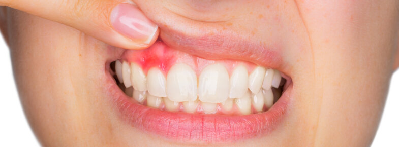 Оригинал статьи - https://ed-m.ru/Poleznye-statqi/Xirurgija/periostitis