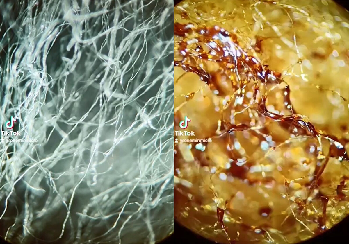 Вата под микроскопом. Лавсан волокно под микроскопом. Волокна ваты под микроскопом х150. Вата под микроскопом. Вата под микроскопом.