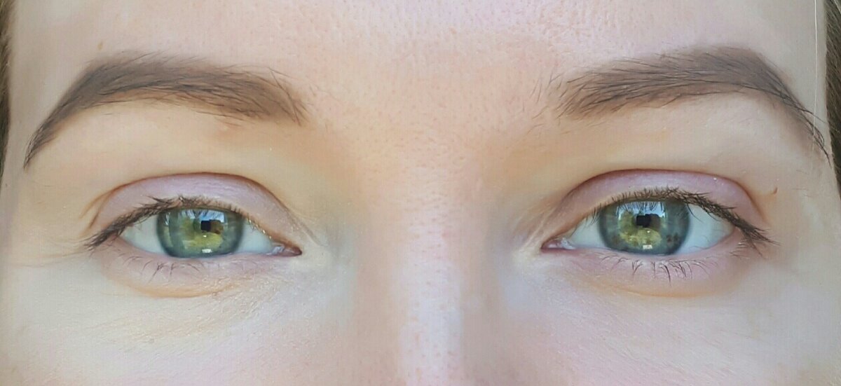 Фото от СмиКорина для Яндекс Дзен. Глаза сфотографированы при улыбке. Если приблизить фото, то на варианте, где нанесено много корректора (слева на фото), морщинки проглядываются сильнее.
