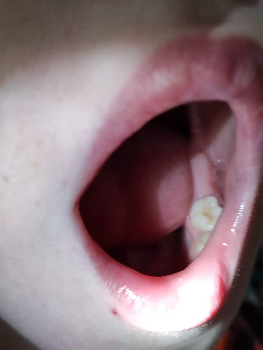 Рот не дочки, а четырехлетнего сына