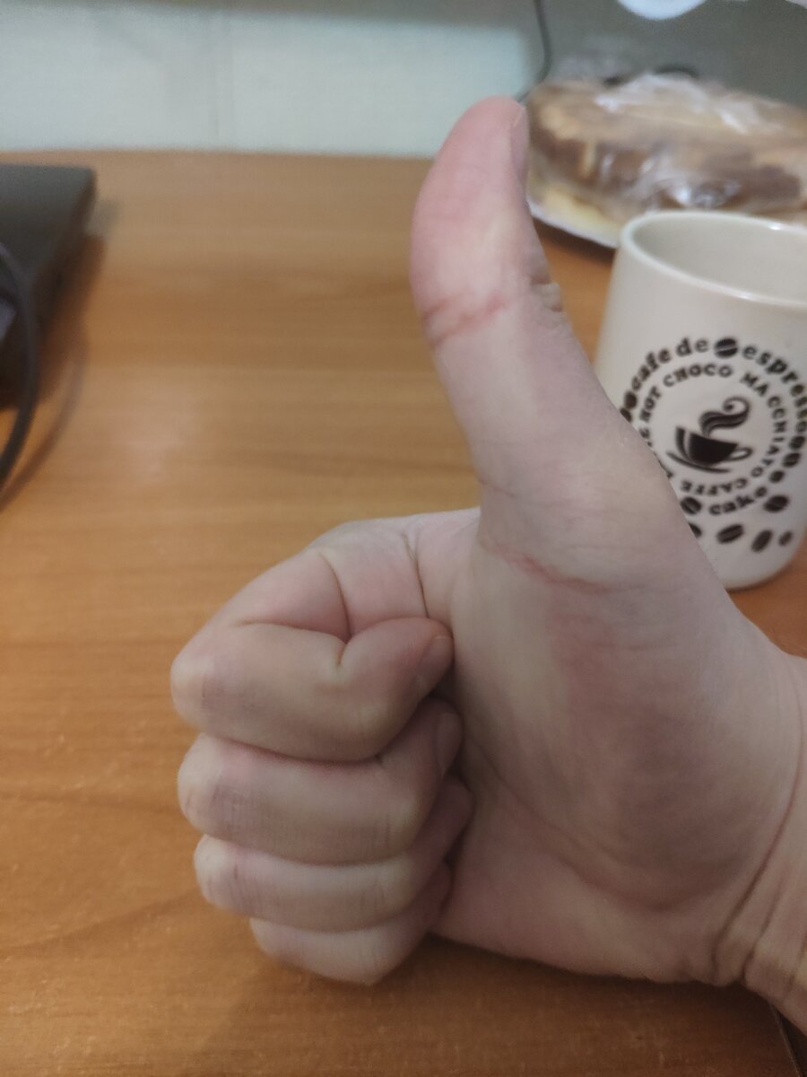 ПОДНЯЛ ПАЛЕЦ ВВЕРХ ЗА ЭТО!