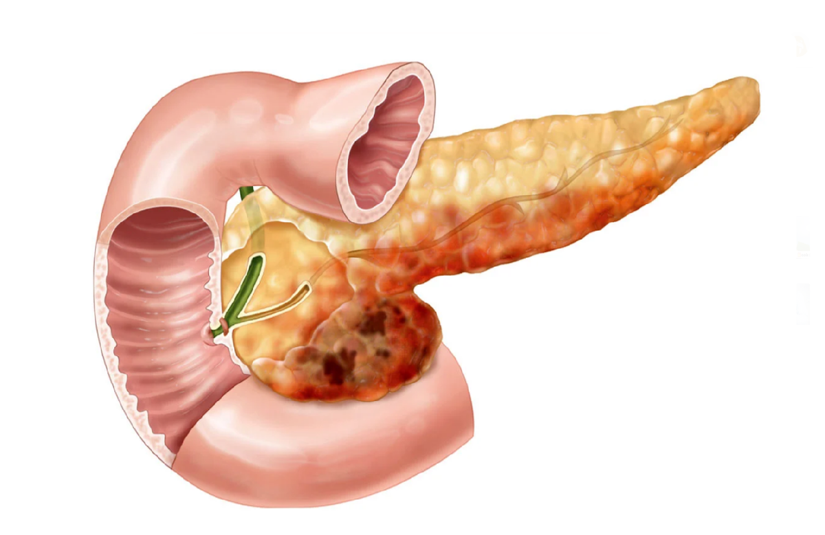 Поджелудочная человека фото