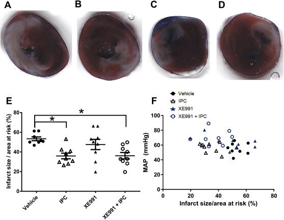7. Влияние ишемического прекондиционирования (ИПК) и ХЕ991 на размер инфаркта миокарда.
Поперечные срезы сердец после окрашивания Эванс-синим и ТТК (2,3,5-трифенилтетразолий хлорид), образцы из опытных групп: vehicle (A), IPC (B), XE991 (C) и XE991 + IPC (D). Бледные участки были поражены инфарктом, красные участки подвергались риску инфаркта, а темные участки были хорошо пропитаны кровью. E) Среднее влияние блокады Kv7 (0,75 мг/кг XE991) и МПК на размер инфаркта миокарда (ИС). F) нормализованный размер инфаркта (IS/AAR), рассчитанный по среднему артериальному давлению (MAP). Никакой связи не было. *P n = 8-9.