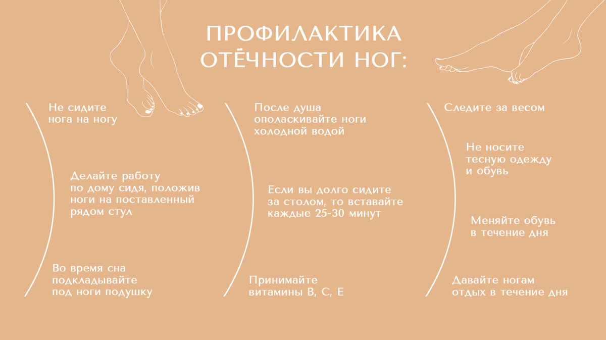 Простые действия для профилактики отёков ног