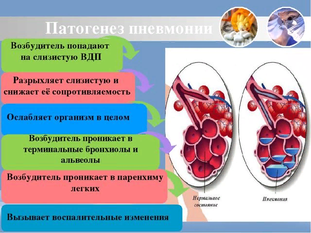 Пневмония у детей: симптомы и лечение | Статьи от МЕДСИ