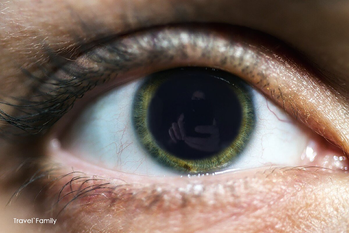 Глаз после мидриатик, капли расширяющие  зрачки