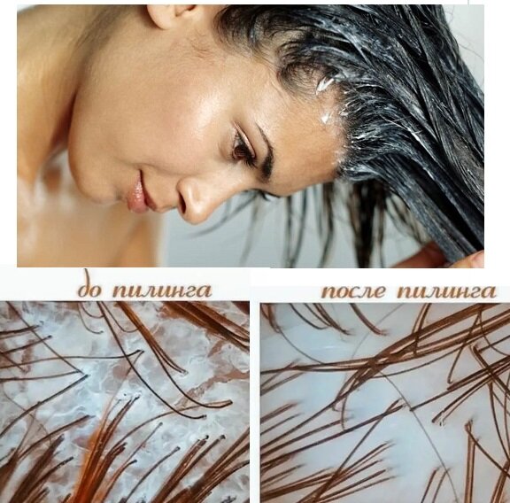 Я добавляю соду в шампунь: волосы объемные у корней, их реже нужно мыть, их  качество улучшается. Что же это может нам дать | health & beauty | Дзен