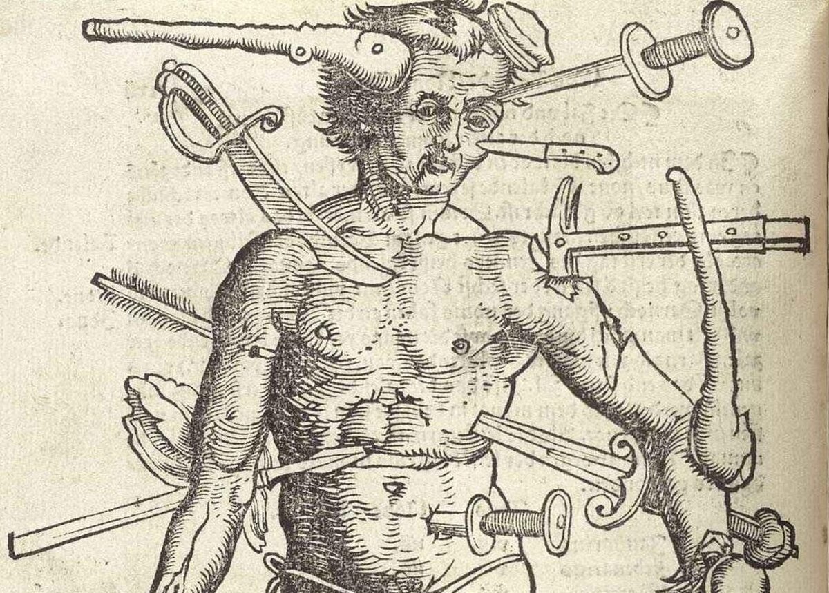 Виды ранений. Картинка из старинного медицинского атласа, XVII век.