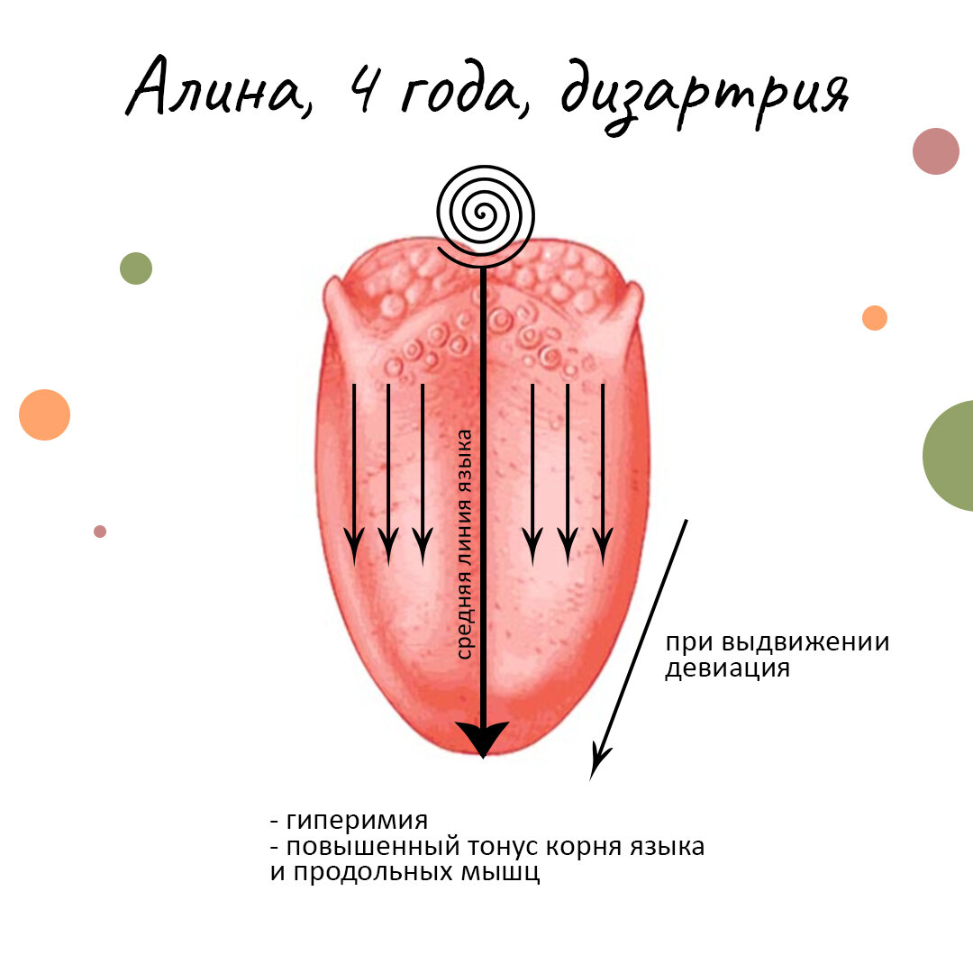 Карта языка