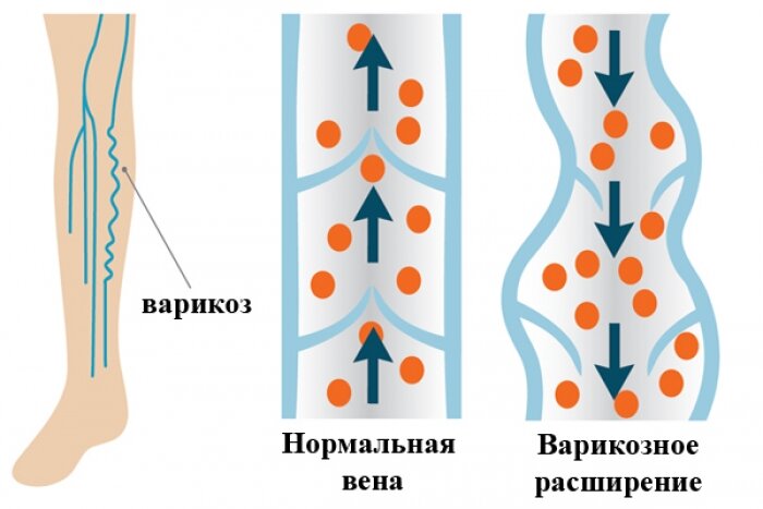 фото: allbreakingnews.ru