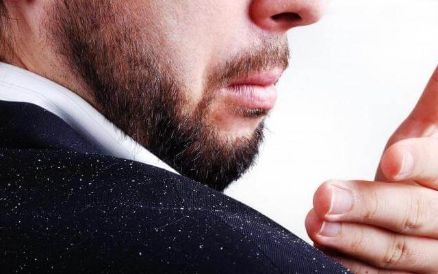 Что такое перхоть и как с ней бороться