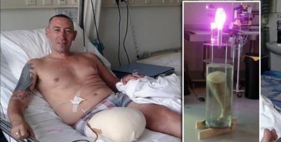 Чтоб оплатить лечение и приобрести протез. 