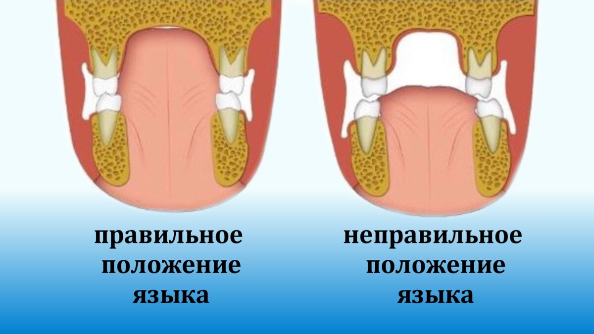 Какое правильное расположение языка