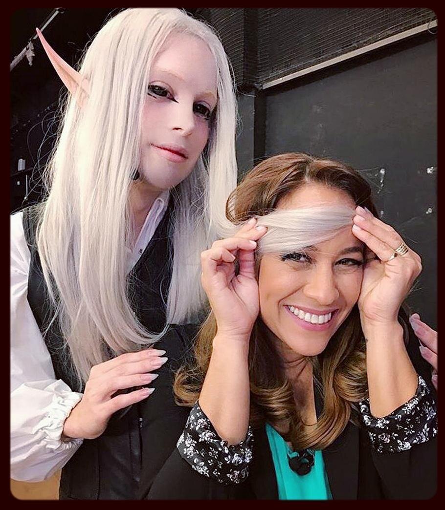 Луис падрон до пластики. Луис падрон эльф до операции. Эльфика в реальной жизни. Луис падрон 2022. Живой эльф» луис падрон.