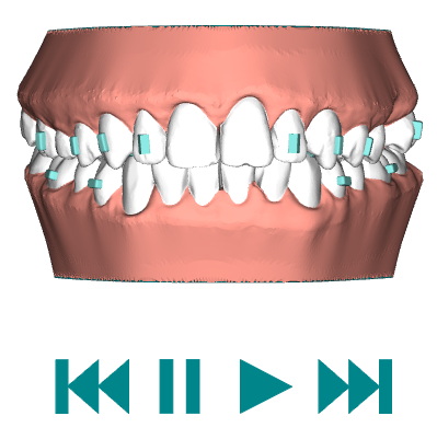 После  36 кап  (план).