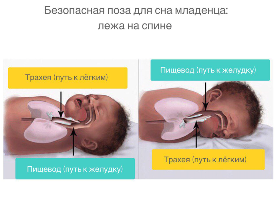 Давлюсь слюной во сне. Положение для сна новорожденных. Правильное положение для сна новорожденного. Положение сна грудничка. Нормальное положение новорожденного во сне.
