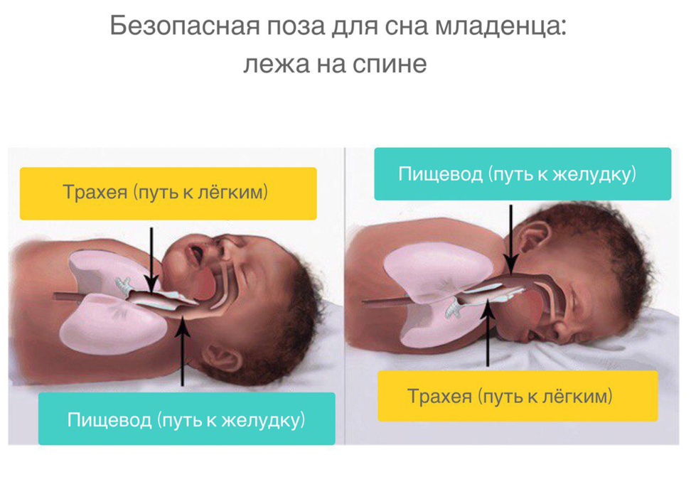 Снится подавиться. Положение для сна новорожденных. Правильное положение для сна новорожденного. Положение грудничка во сне. Нормальное положение новорожденного во сне.