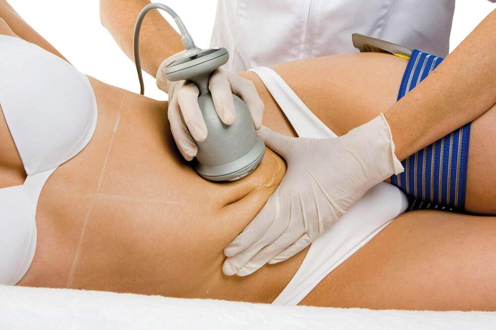 кавитация живота