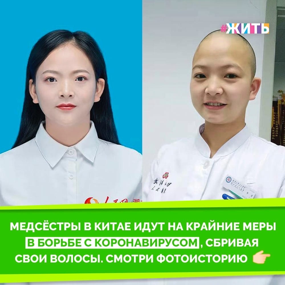 Сотни медсестер и врачей прилагают все усилия для борьбы с коронавирусом каждый день с начала вспышки. Эпидемия достигла 27 стран, но подавляющее большинство случаев было в Китае. Несмотря на то, что, по-видимому, вспышка вируса в Китае потихоньку утихает, он все еще считается серьезной угрозой, и тысячи зараженных людей остаются в руках медицинских работников. Количество пациентов заставило медсестер и врачей принять крайние меры для более эффективного лечения пациентов. Одной из таких мер является бритье головы, чтобы снизить риск перекрёстного загрязнения и не дать микроорганизмам распространиться☝️

Эпидемия сильно сказывается на медперсонале. У медсестер и врачей остаются синяки и следы от масок, впивающихся в их кожу, которая, ко всему прочему, страдает от дезинфицирующих средств. Многие из них физически истощены. Но, несмотря на все это, они продолжают свою работу. Вот настоящие герои! Вы согласны?🙌

#жить #проектжить #добро #подвиг